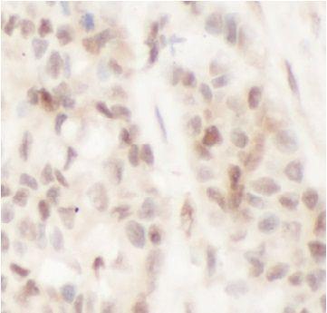 anti- SIRT1 antibody