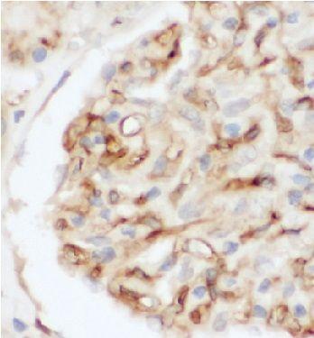 anti- ALPL antibody