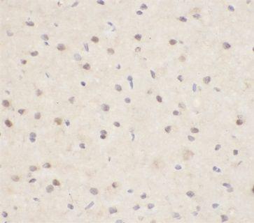 anti- Aβ42 antibody