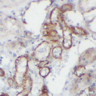 anti- AGR2 antibody