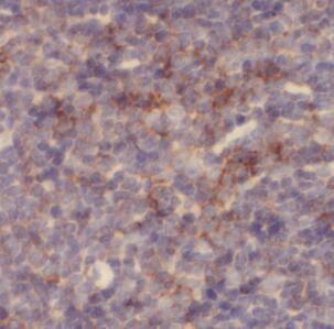 Anti-CD137 antibody