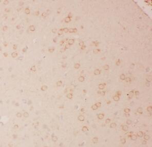 anti-IL-13 antibody