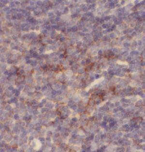 anti-TLR2 antibody