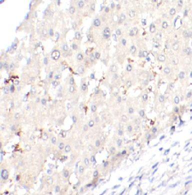 anti- TREM1 antibody