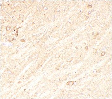 anti- CADM1 antibody