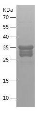 Recombinant Human HMGB1