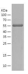 Recombinant Human CRKIL