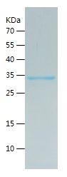 Recombinant Human SIRT1