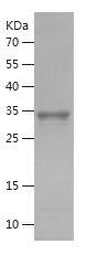 Recombinant Human ALPL