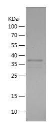 Recombinant Human SERPINA1