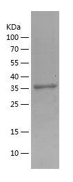 Recombinant Human ACAT1