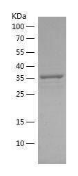 Recombinant Human ACOX1