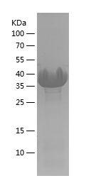 Recombinant Human AGR2