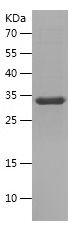 Recombinant Human CD11A