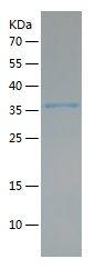 Recombinant Human CD206