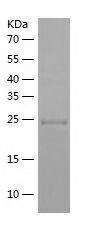 Recombinant Human CD11c