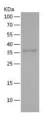 Recombinant Human APOB