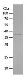 Recombinant Human AKR1CL2