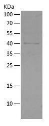 Recombinant Human ADA