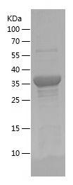 Recombinant Human DAB2