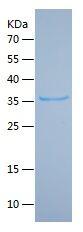 Recombinant Human KRT1