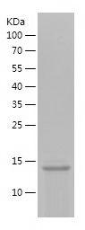 Recombinant Human KISS1