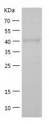 Recombinant Human CETP