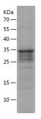 Recombinant Human ACTA2