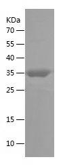 Recombinant Human NPHS2