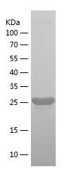 Recombinant Human ROBO4