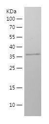 Recombinant Human CD36