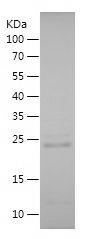 Recombinant Human YAP1