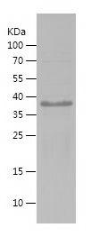 Recombinant Human SIRT1-1