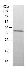 Recombinant Human IGFBP3