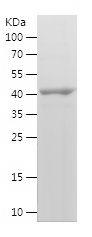 Recombinant Human CD105