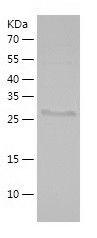 Recombinant Human AMACR