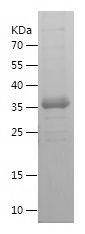 Recombinant Human PIM2