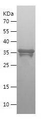 Recombinant Human ITGB1