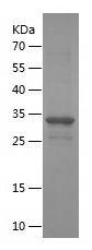 Recombinant Human TFAP2B