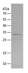 Recombinant Human PXDN