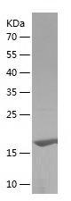 Recombinant Human AGR2