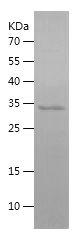 Recombinant Human Hepc