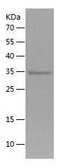 Recombinant Human LGR6