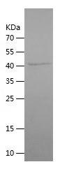 Recombinant Human ORM2