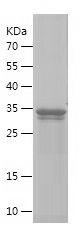 Recombinant Human KISS1R