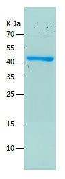 Recombinant Human SART3