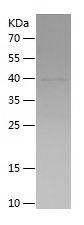 Recombinant Human TLR9