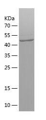 Recombinant Human ABCD1