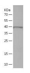 Recombinant Human IL17RB