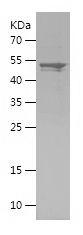 Recombinant Human PALLD